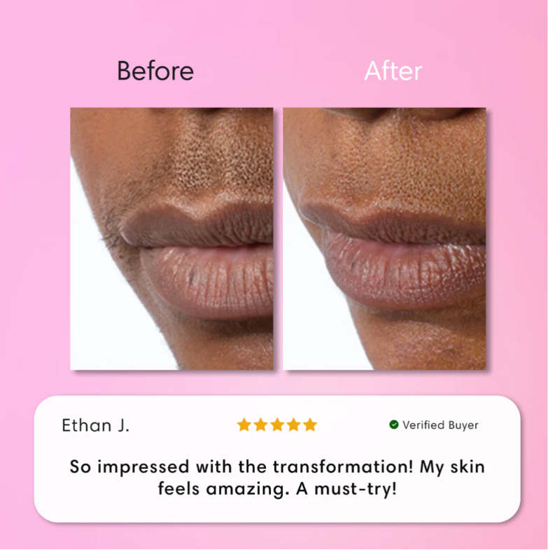 Kit Épilation Visage Instantané - Crème Douce + Gel Apaisant | Peau Nette en 5 min