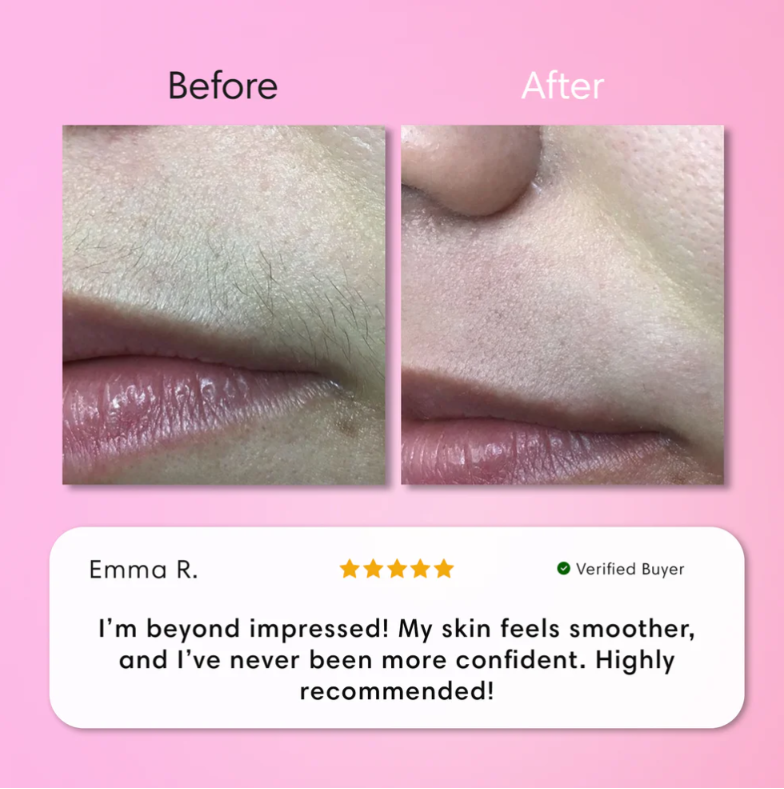 Kit Épilation Visage Instantané - Crème Douce + Gel Apaisant | Peau Nette en 5 min