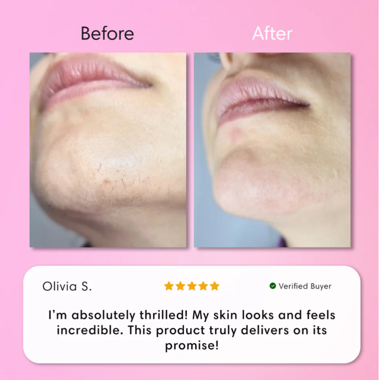 Kit Épilation Visage Instantané - Crème Douce + Gel Apaisant | Peau Nette en 5 min