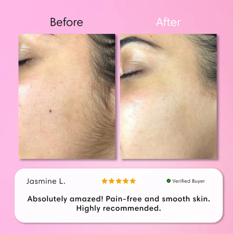 Kit Épilation Visage Instantané - Crème Douce + Gel Apaisant | Peau Nette en 5 min